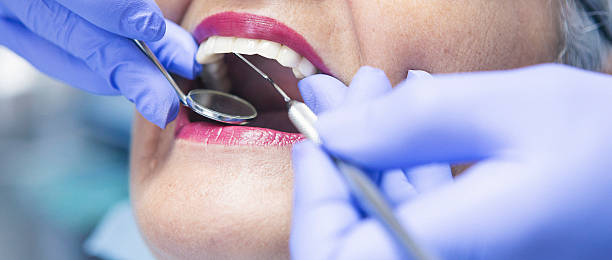 Best Dentist for Tooth Abscess  in Frazeysburg, OH